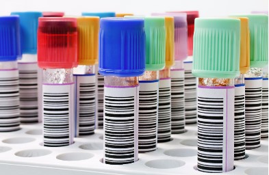 The High Cost of Label Failure